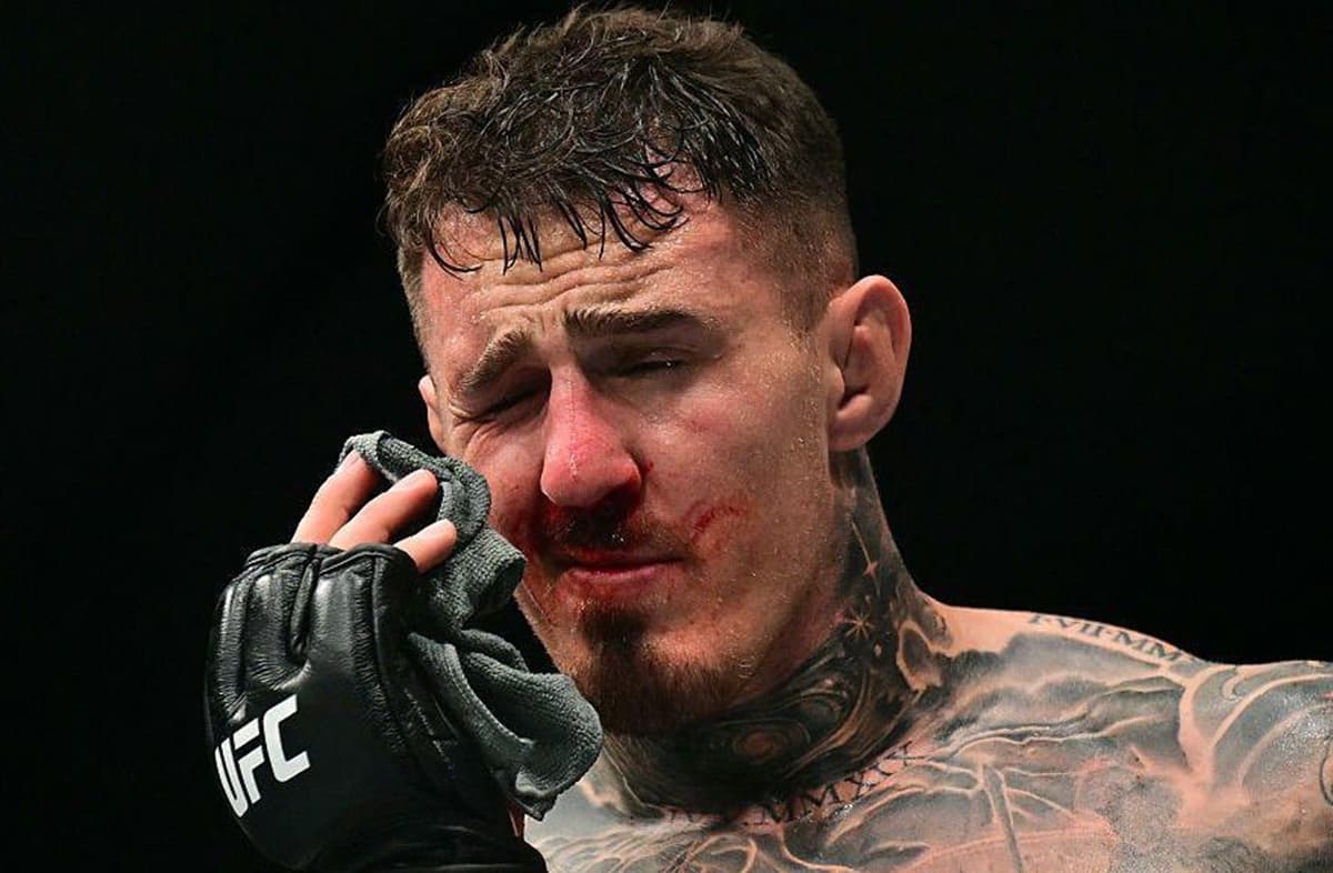 Tom Aspinall renonce à la ceinture UFC : ses problèmes oculaires l’empêchent de défendre son titre