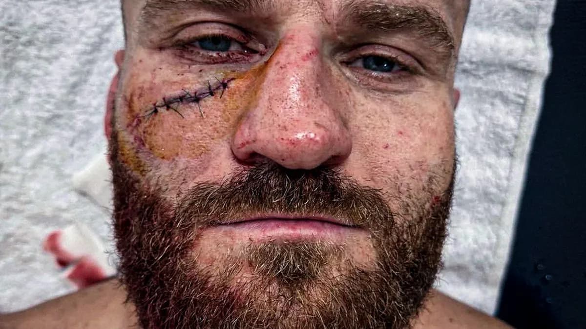 Coup au visage : Blachowicz révèle sa blessure après KO à l'UFC Belgrade Coup au visage : Blachowicz révèle sa blessure après KO à l'UFC Belgrade